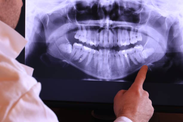 Best Chipped Tooth Repair Near Me  in Monte Alto, TX